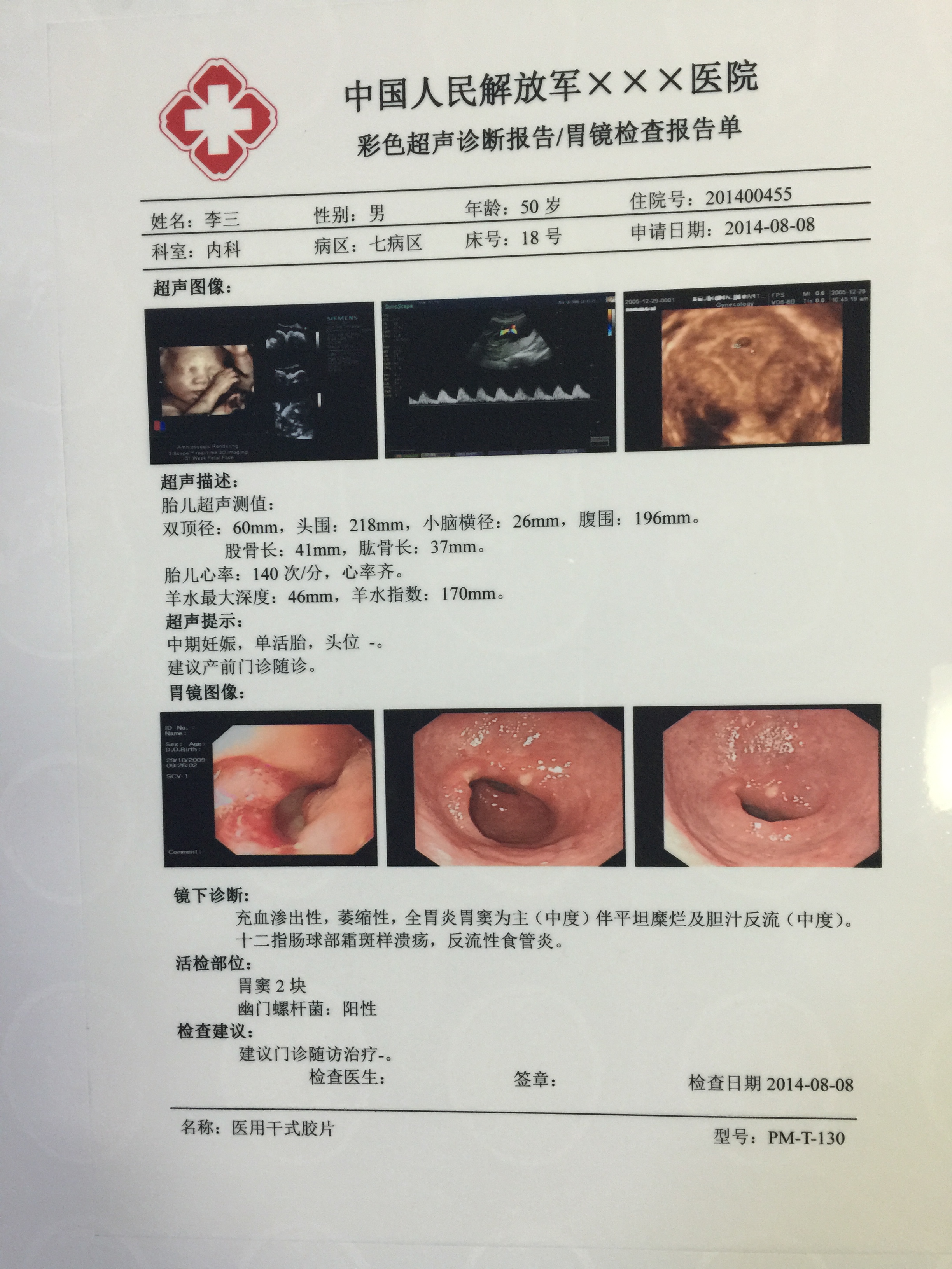 医用干式胶片喷墨PM-T-130彩超胃镜图片