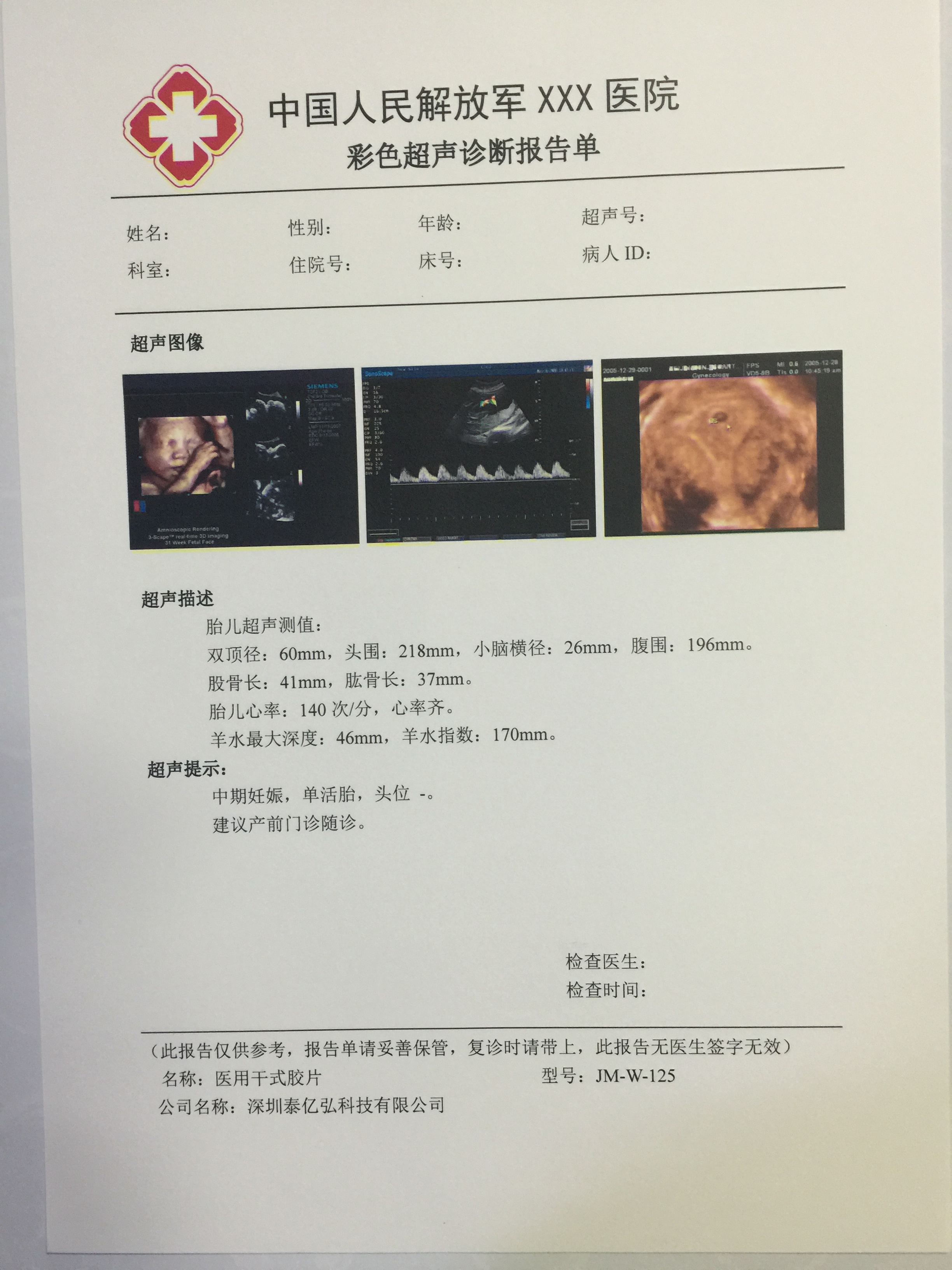 干式胶片防水防曝光医用胶片耗材图片