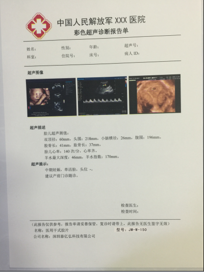 医用胶片干式放射无银盐胶片瓷白图片