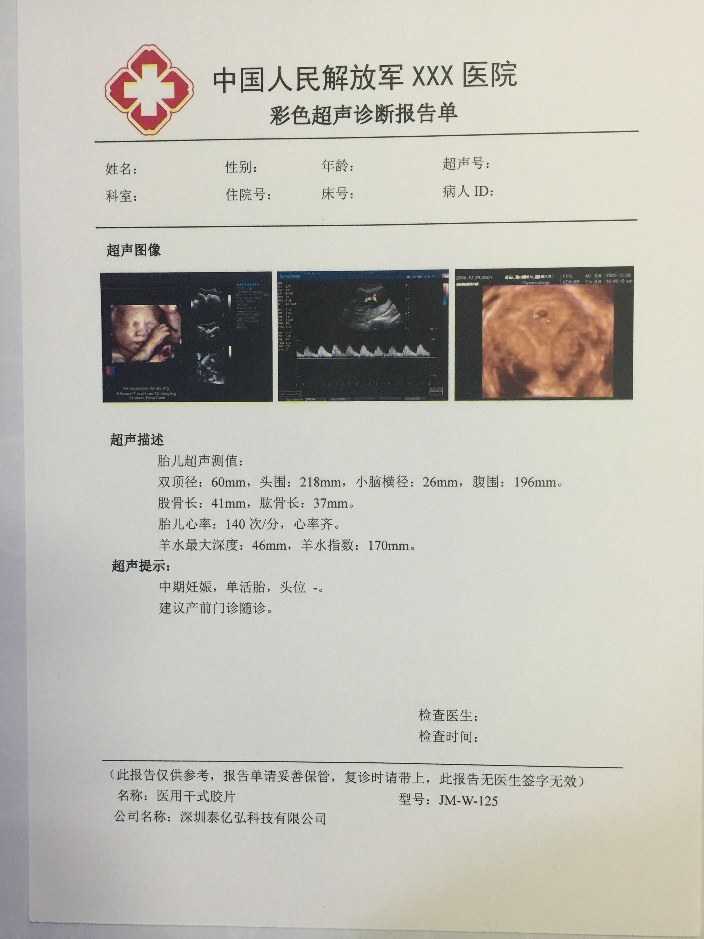 供应激光瓷白超声胶片X光胶片医用干式胶片JM-W-125 B5无银盐防水胶片打印胶片批发好质量正品保证