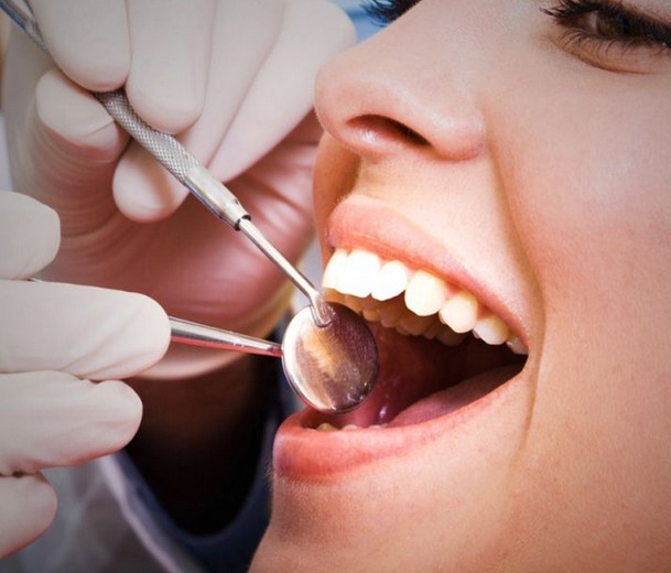 牙齒矯正圖片/牙齒矯正樣板圖 (4)