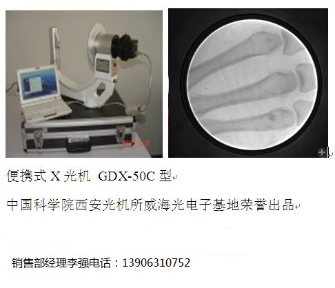 低剂量便携式X光机 低剂量手提式X光机