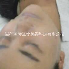 天鵝絨煥膚多少錢,天鵝絨換膚價格【品輝國際】現(xiàn)貨供應(yīng)