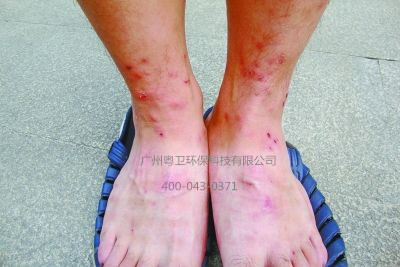 滅跳蚤公司圖片/滅跳蚤公司樣板圖 (1)