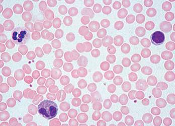 奧林巴斯體視顯微鏡圖片/奧林巴斯體視顯微鏡樣板圖 (4)