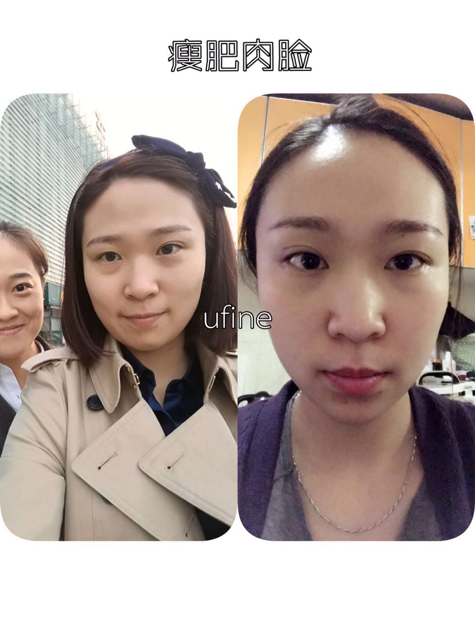 ufine精油好用嗎 ufine優(yōu)梵精油小伴侶有*嗎