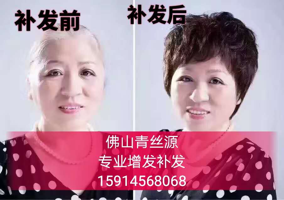 女士真人假發(fā)圖片/女士真人假發(fā)樣板圖 (1)