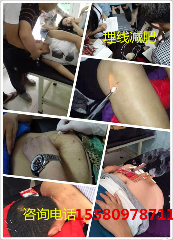 佛山哪里有學中醫(yī)針灸比較便宜圖片/佛山哪里有學中醫(yī)針灸比較便宜樣板圖 (3)