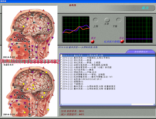 5D-mra光波聲納共振掃描分析圖片/5D-mra光波聲納共振掃描分析樣板圖 (2)