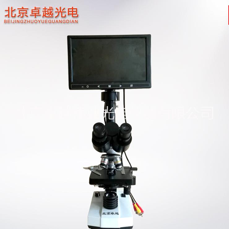 北京卓越 高清雙目一滴血檢測(cè)儀圖片