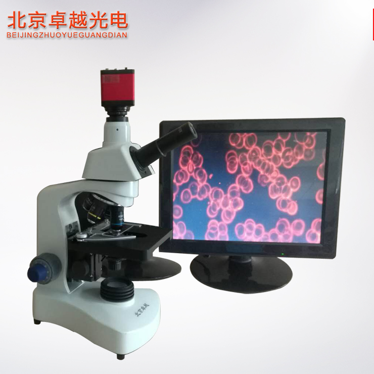 北京卓越 黑背景一滴血檢測儀VG圖片