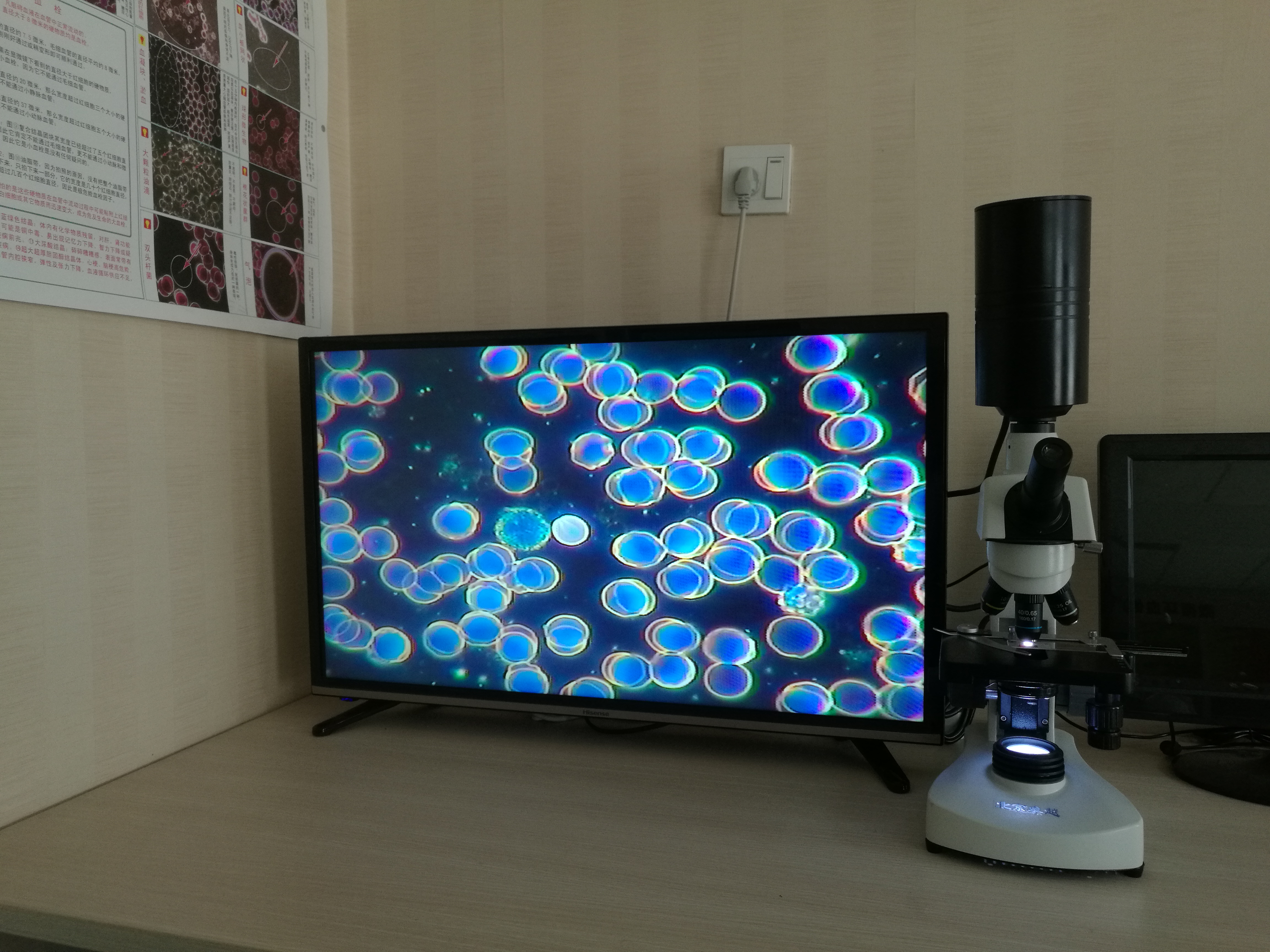 滴血檢測儀圖片/滴血檢測儀樣板圖 (3)