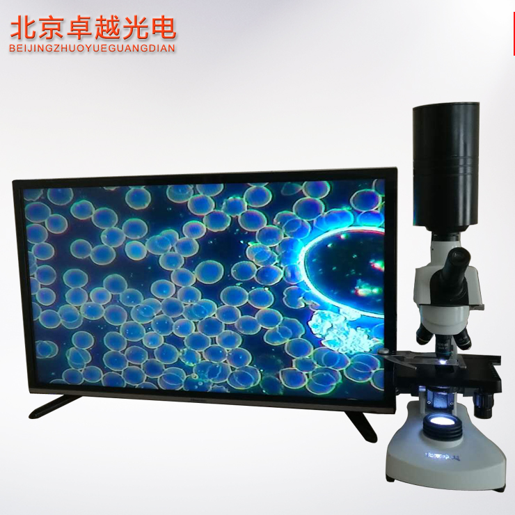 滴血檢測儀圖片/滴血檢測儀樣板圖 (1)