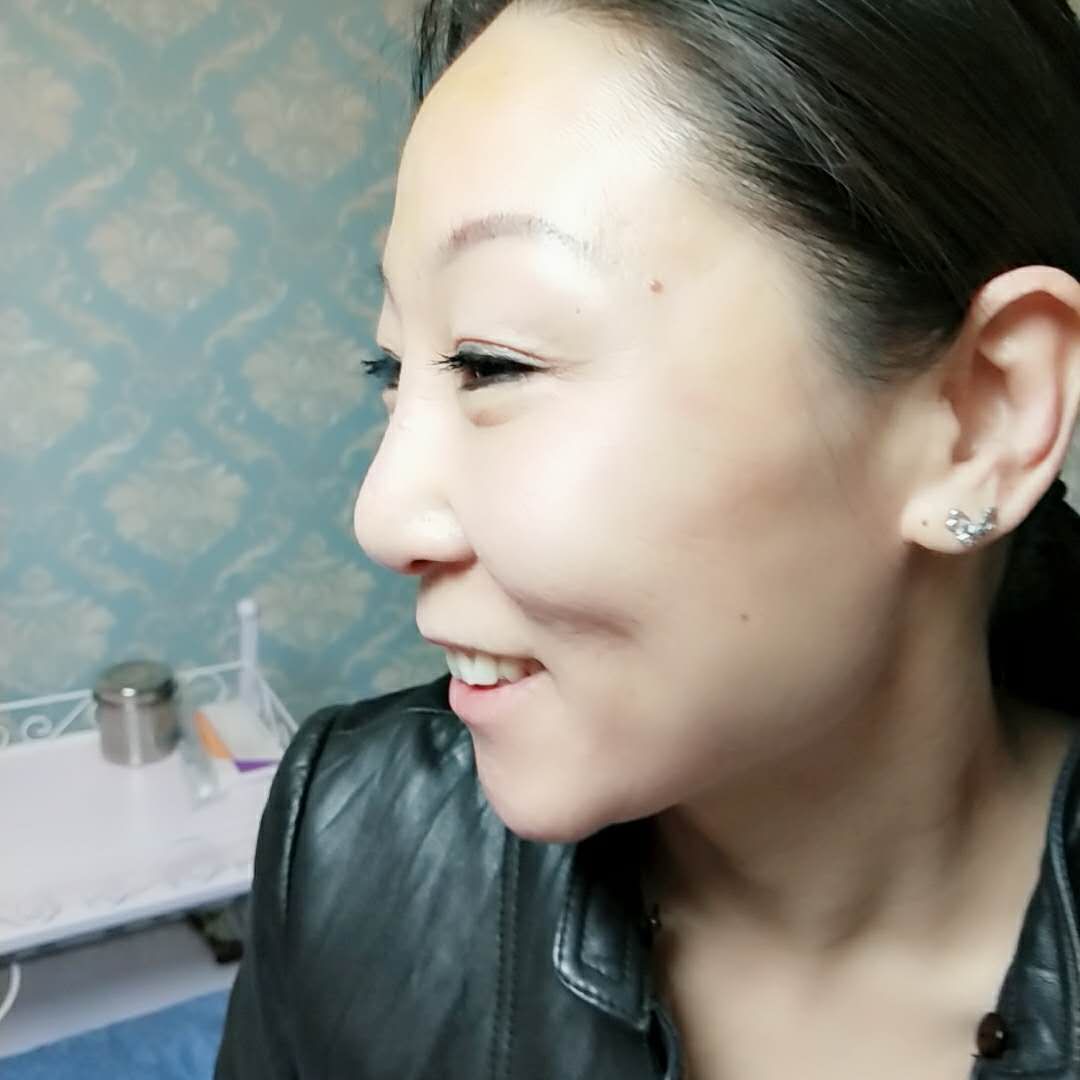 薇琴去皺江蘇市場(chǎng)有沒(méi)有圖片/薇琴去皺江蘇市場(chǎng)有沒(méi)有樣板圖 (4)