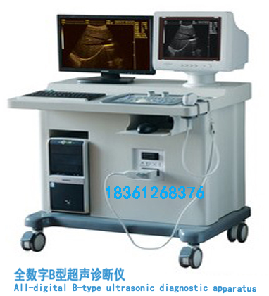 全数字B型超声诊断仪黑白B型超机