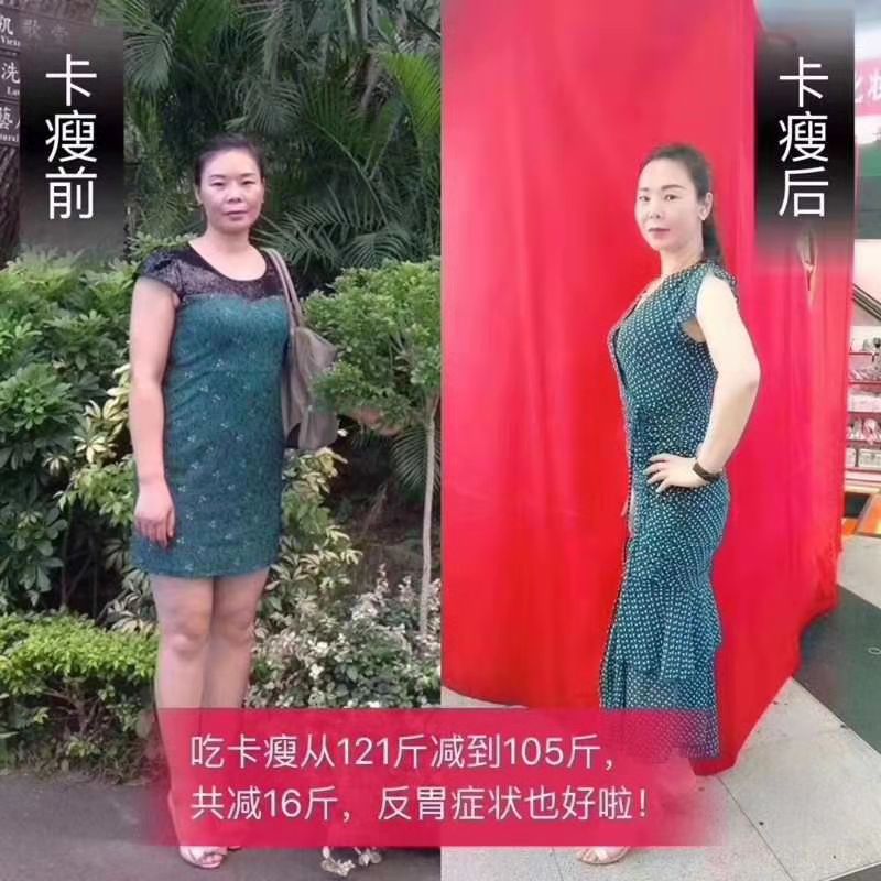 卡瘦代理價(jià)格表圖片/卡瘦代理價(jià)格表樣板圖 (2)