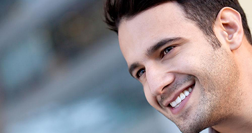 牙齒貼面美白圖片