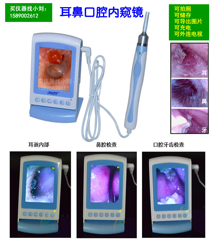 耳鼻喉口内窥镜 可视化体表检测仪 电子鼻镜采耳镜可拍照充电厂家直销图片