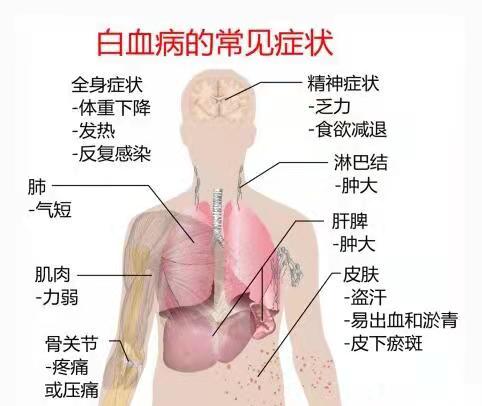 增城新车除异味服务热线电话-新车除异味要多少钱-新车除异味公司图片