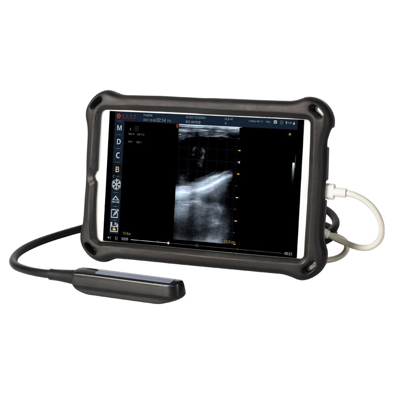 高清獸用B超機(jī)圖片/高清獸用B超機(jī)樣板圖 (2)