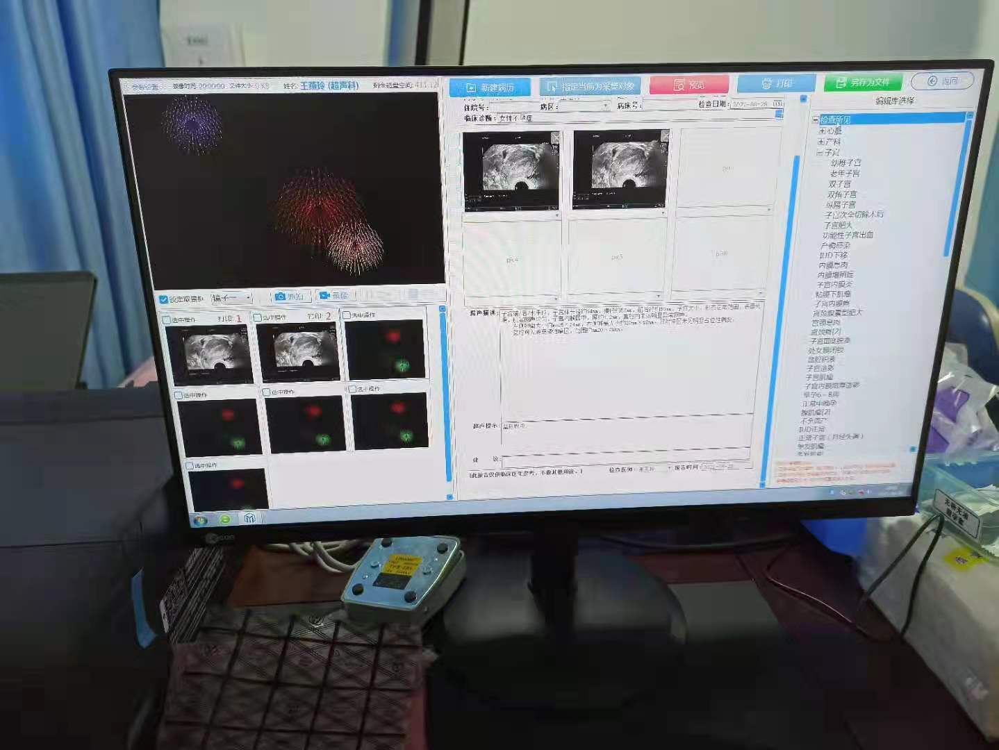 超声图文工作站（标清）图片