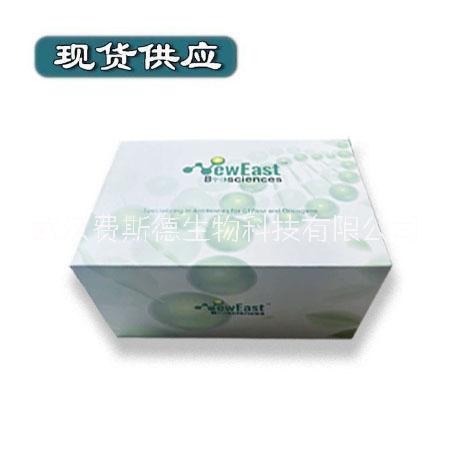 Rac-GTP 小鼠單抗/費(fèi)斯德圖片/Rac-GTP 小鼠單抗/費(fèi)斯德樣板圖 (2)