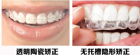 大學(xué)生牙齒矯正、牙齒矯正優(yōu)惠 劉淑英口腔診所