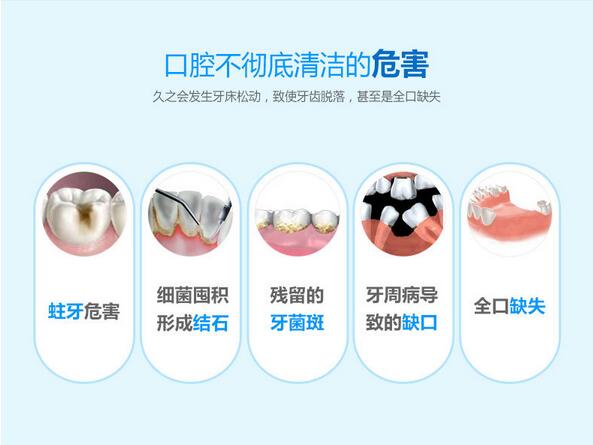 百力英倫成人聲波牙刷 杜邦刷毛 一鍵式開關(guān) 30秒計時提醒