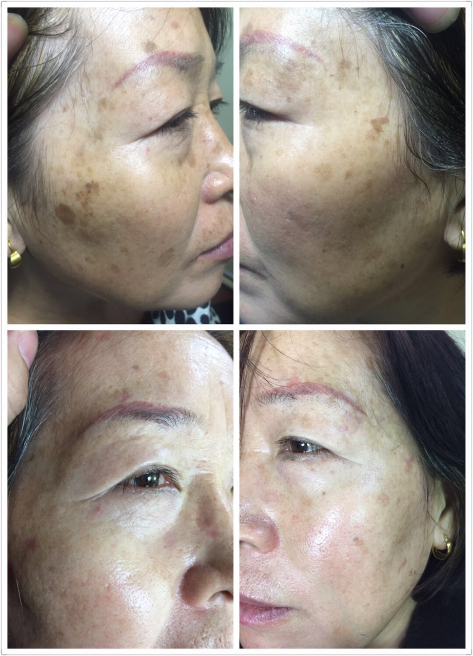 祛斑祛斑祛斑 祛斑祛斑祛斑祛斑