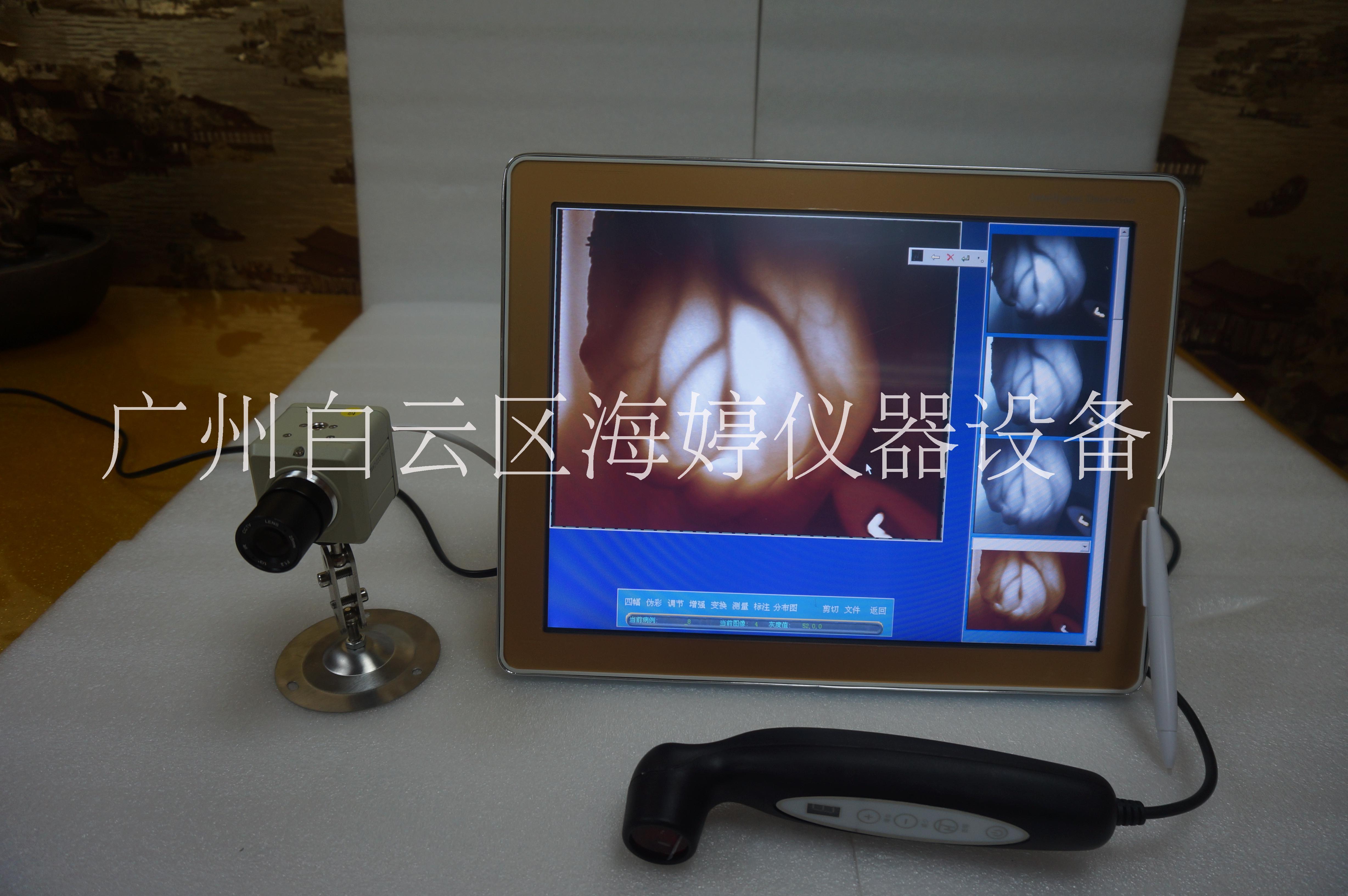 新款觸摸乳腺檢測儀 婦科檢測儀直銷 婦科檢測儀*廠家