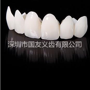 美國(guó)進(jìn)口二氧化鋯全瓷牙 3M拉瓦易美三代國(guó)產(chǎn)愛爾創(chuàng)深圳廠家優(yōu)惠直銷