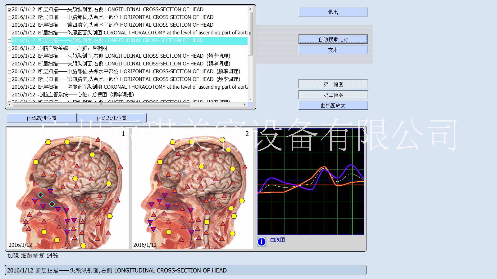 9D非線性健康檢測智能觸摸一體機(jī)，9D*光波檢測儀，*檢測儀，亞健康檢測儀，健康檢測儀