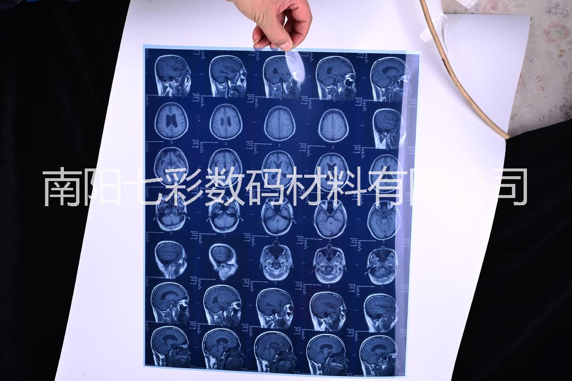 醫(yī)用藍基白基防水噴墨雙面激光膠片