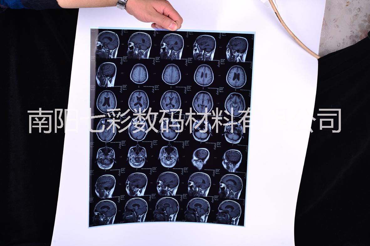 醫(yī)用B超X光CT核磁共振防水噴墨激光膠片  醫(yī)用B超X光CT核磁共振防水膠片