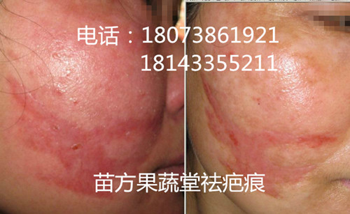 湖南*修復(fù)中心 苗方果蔬堂加盟