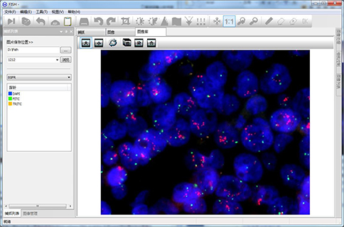 MFISH熒光原位雜交分析系統(tǒng)