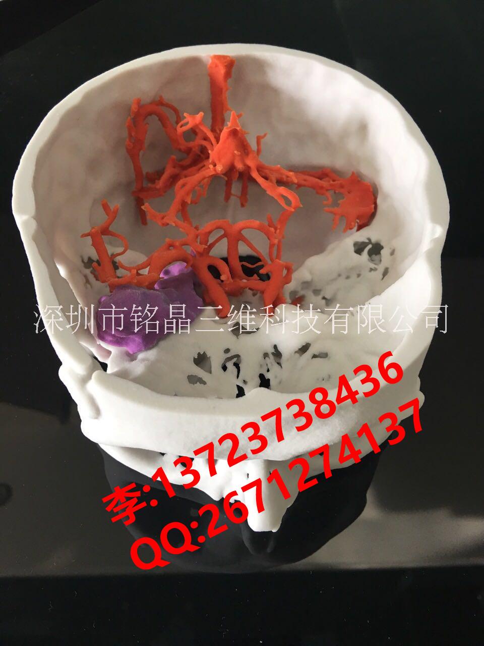 3D打印醫(yī)療模型||醫(yī)療教學(xué)模型