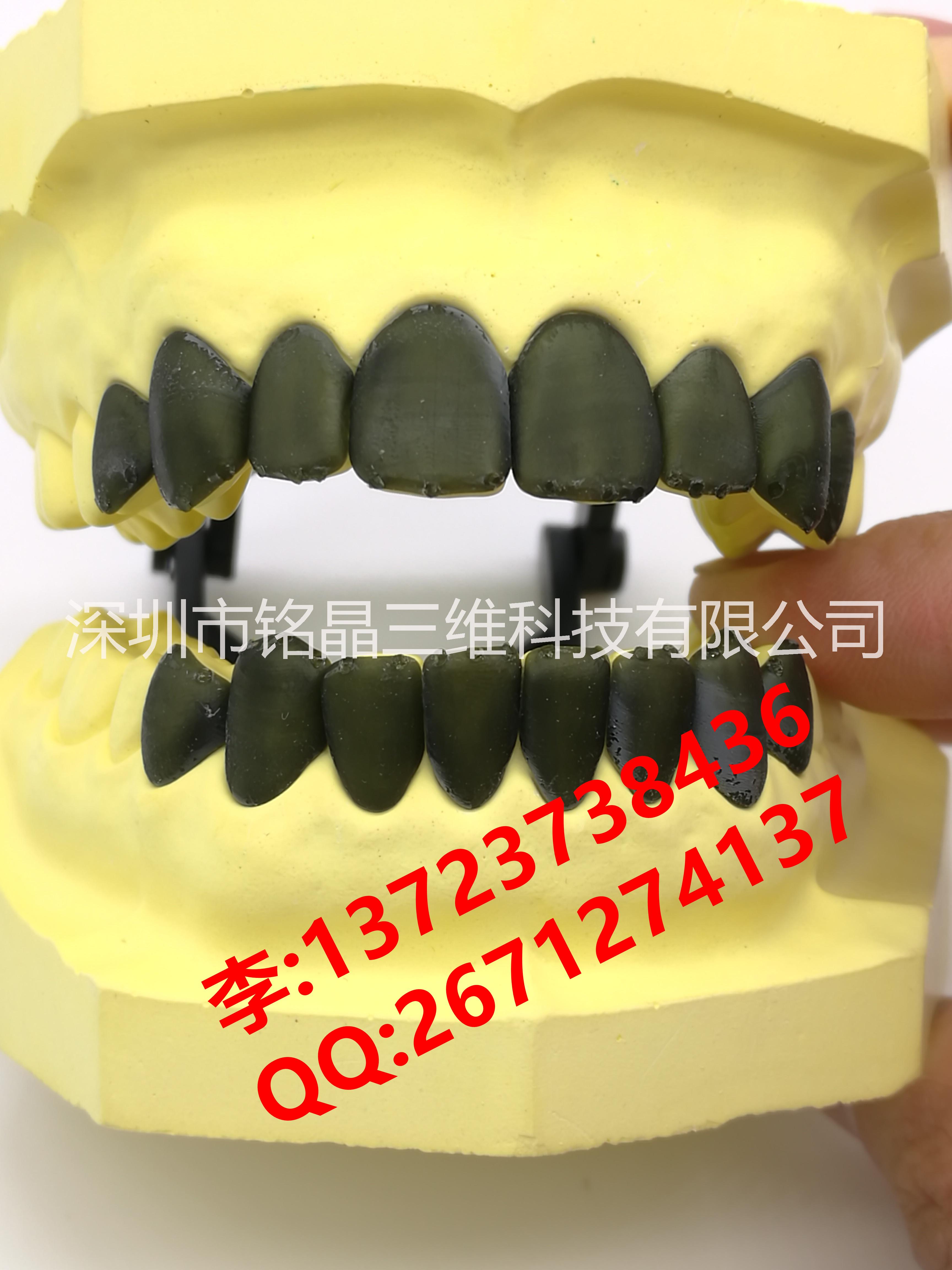 3D打印醫(yī)療模型||醫(yī)療教學(xué)模型