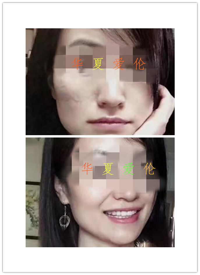 重慶*修復(fù) 重慶如何淡化*  重慶簽約*