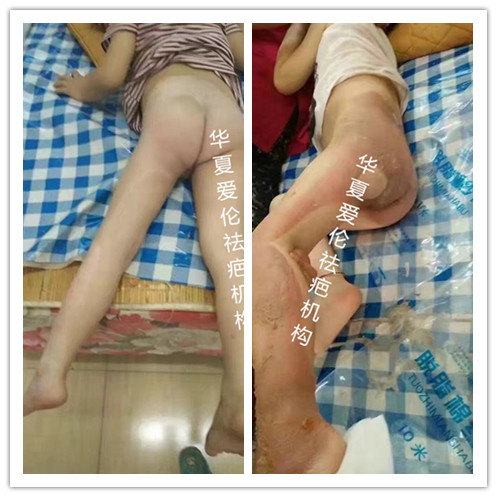 重慶*修復(fù) 重慶怎樣* 重慶如何* 重慶剖腹產(chǎn)* 重慶手術(shù)*