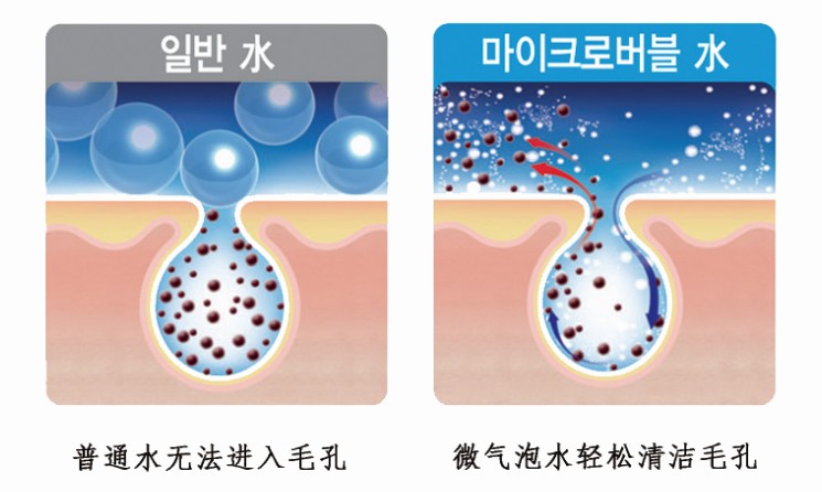 微氣泡護(hù)膚 微氣泡水護(hù)膚