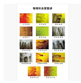 微循環(huán)檢測儀