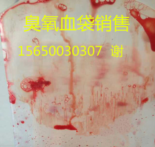 三氧大自血耗材才、南格爾臭氧血袋