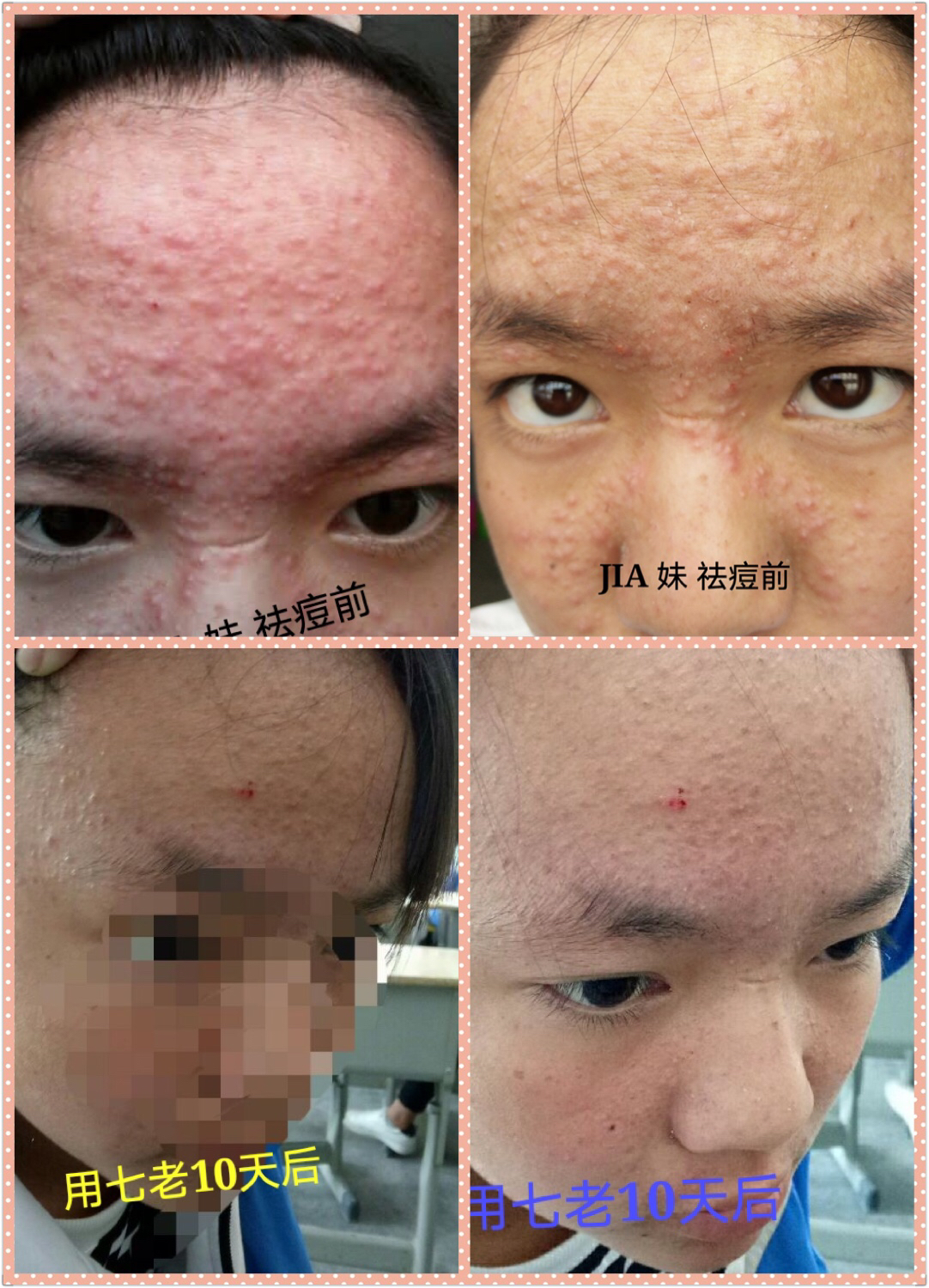 七老護膚官方網(wǎng)站 七老*實體店總經(jīng)銷 七老燕子團隊全國招募七老代理   七老招代理