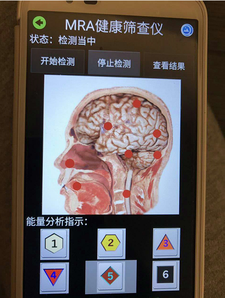手機(jī)版3D檢測(cè)儀 3D健康檢測(cè)系