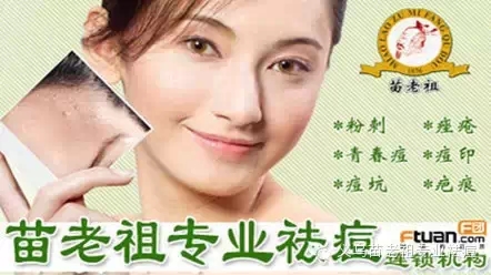 義烏專業(yè)祛痘苗老祖祛痘價(jià)格*效
