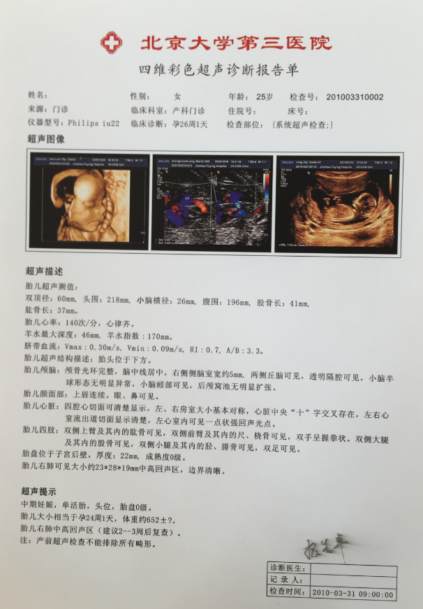 半透激光醫(yī)用干式膠片（超聲科） 醫(yī)用激光打印耗材半透膠片