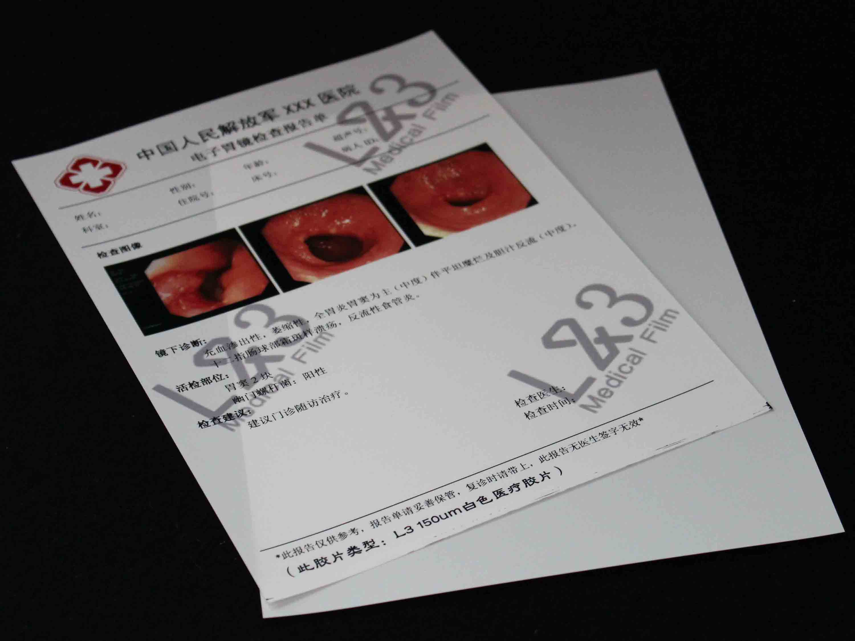 瓷白激光(雙面)醫(yī)用干式膠片