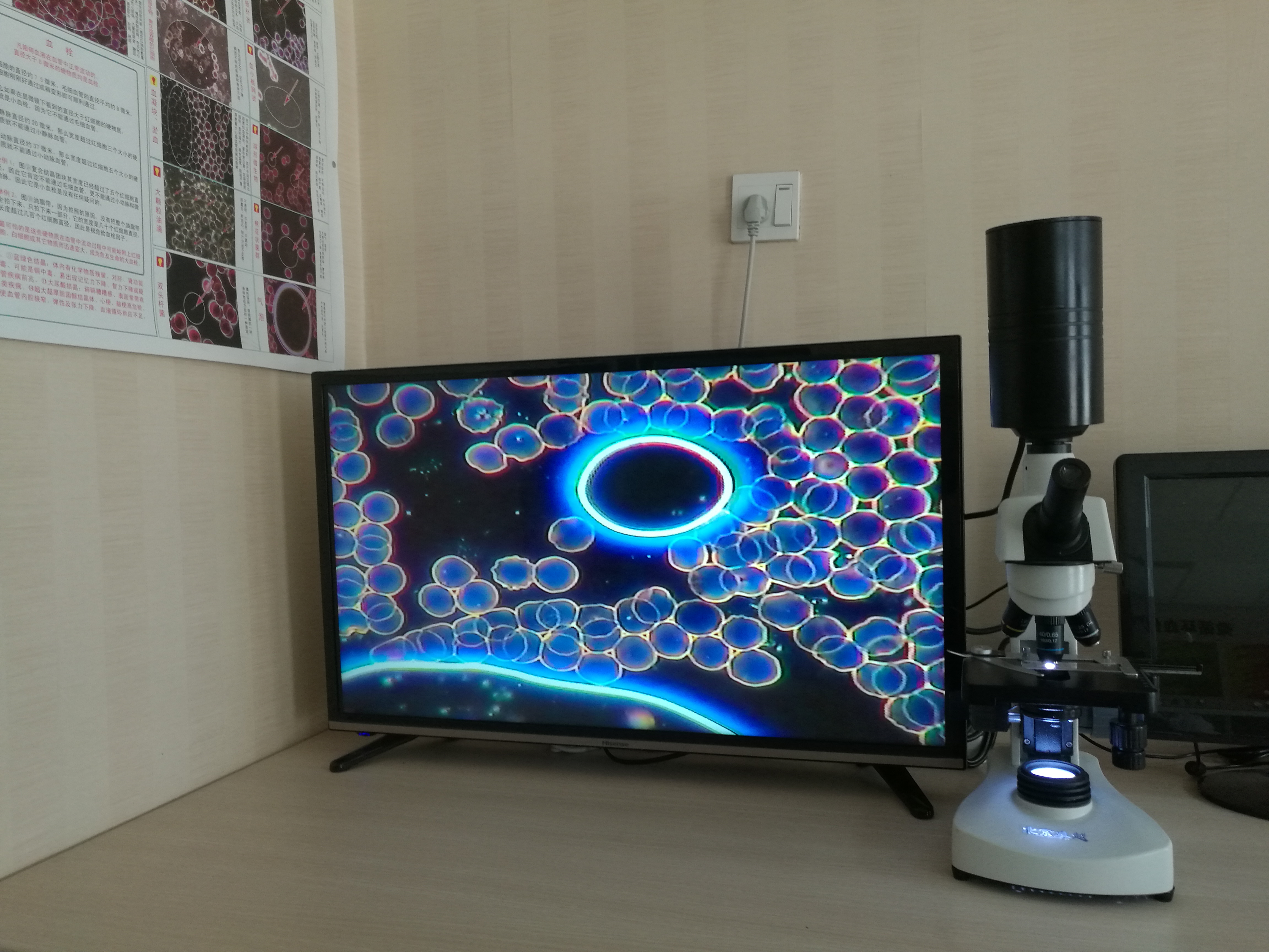 北京*GLS黑背景一滴血檢測儀