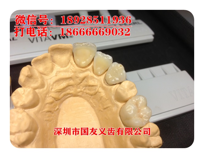 深圳廠家直銷澤康全瓷牙授權(quán)全瓷牙*惠 鋯全瓷